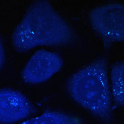 Cholesterol in cells